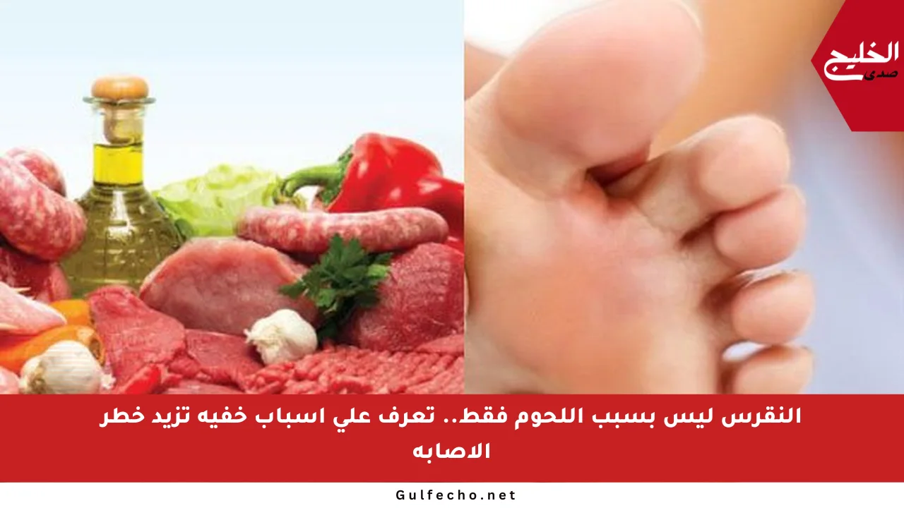 النقرس ليس بسبب اللحوم فقط.. تعرف على أسباب خفية تزيد خطر الإصابة